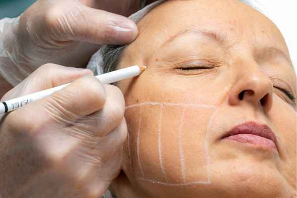 CryoPen: 5 Skin Concerns It May Be Used to Treat 4 What should you ask before having CryoPen treatment Hemel Hempstead?