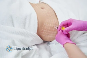 Are The Results From Aqualyx Permanent? 1 Do you want to know how long Aqualyx Hemel Hempstead results last?
