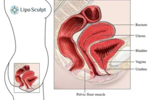 Treatment For A Leaky Bladder 2 How EM Chair treatment Hemel Hempstead can help Leaky bladder issues. Read more now!