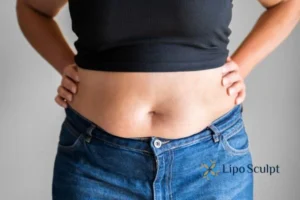 Bidding Farewell to Muffin Tops with Aqualyx Fat Injections 2 Do you wish you could reduce your muffin top Hemel Hempstead With Aqualy fat dissolving injections you can!