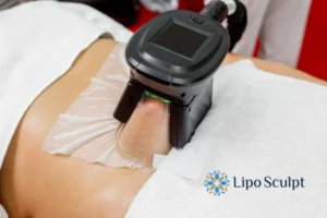 Does Fat Freezing At Home Work? 3 Fat freezing at home from Lipo Sculpt Hemel Hempstead