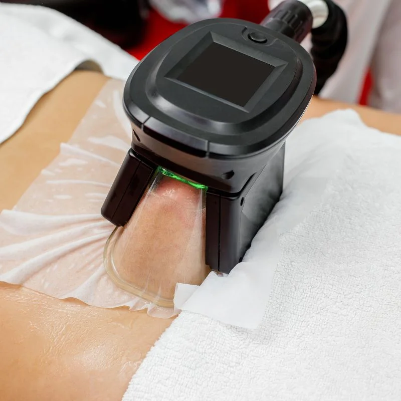 Fat Freezing treatment Hemel Hempstead